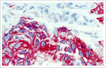 Histopathology test